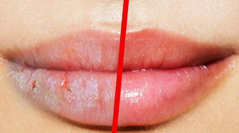 ¡¡HOT SALE!! KISS BEAUTY BÁLSAMO HIDRATANTE DE ALOE VERA PARA LABIOS
