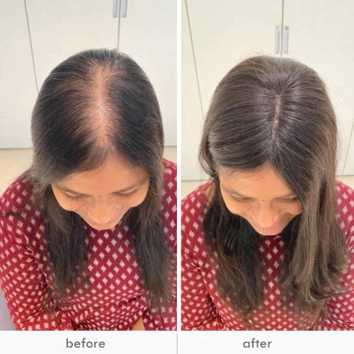¡EN TENDENCIA! EXTENSIÓN DE CABELLO BELLA MKT A
