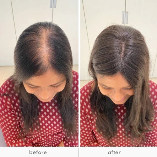 ADICIONAL EXTENSIÓN DE CABELLO BELLA